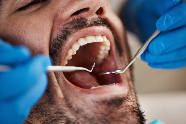 Best Broken or Cracked Tooth Emergency Dentist in Brighton, TN