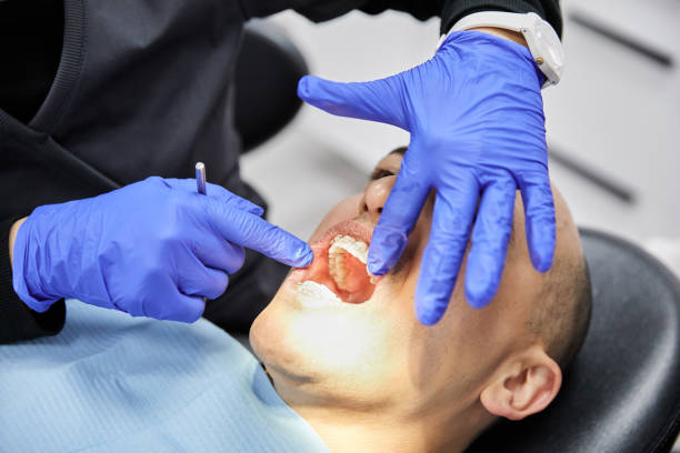 Best Emergency Dentist for Lost Fillings or Crowns in Brighton, TN